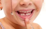 Zahndurchbruch der Milchzähne bei Babys und der Durchbruch bleibender Zähne